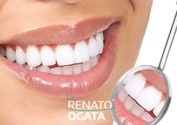 Como Ter Um Sorriso Bonito — 7 Cuidados Para Sua Estética Bucal