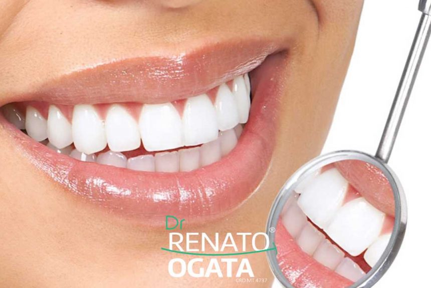 Como Ter Um Sorriso Bonito — 7 Cuidados Para Sua Estética Bucal