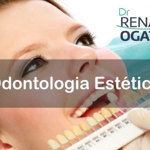 Odontologia Estética em Sinop