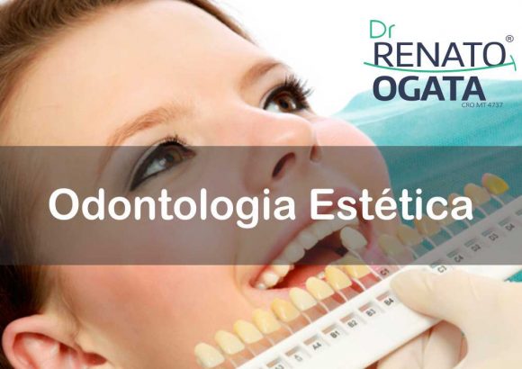 Odontologia Estética em Sinop